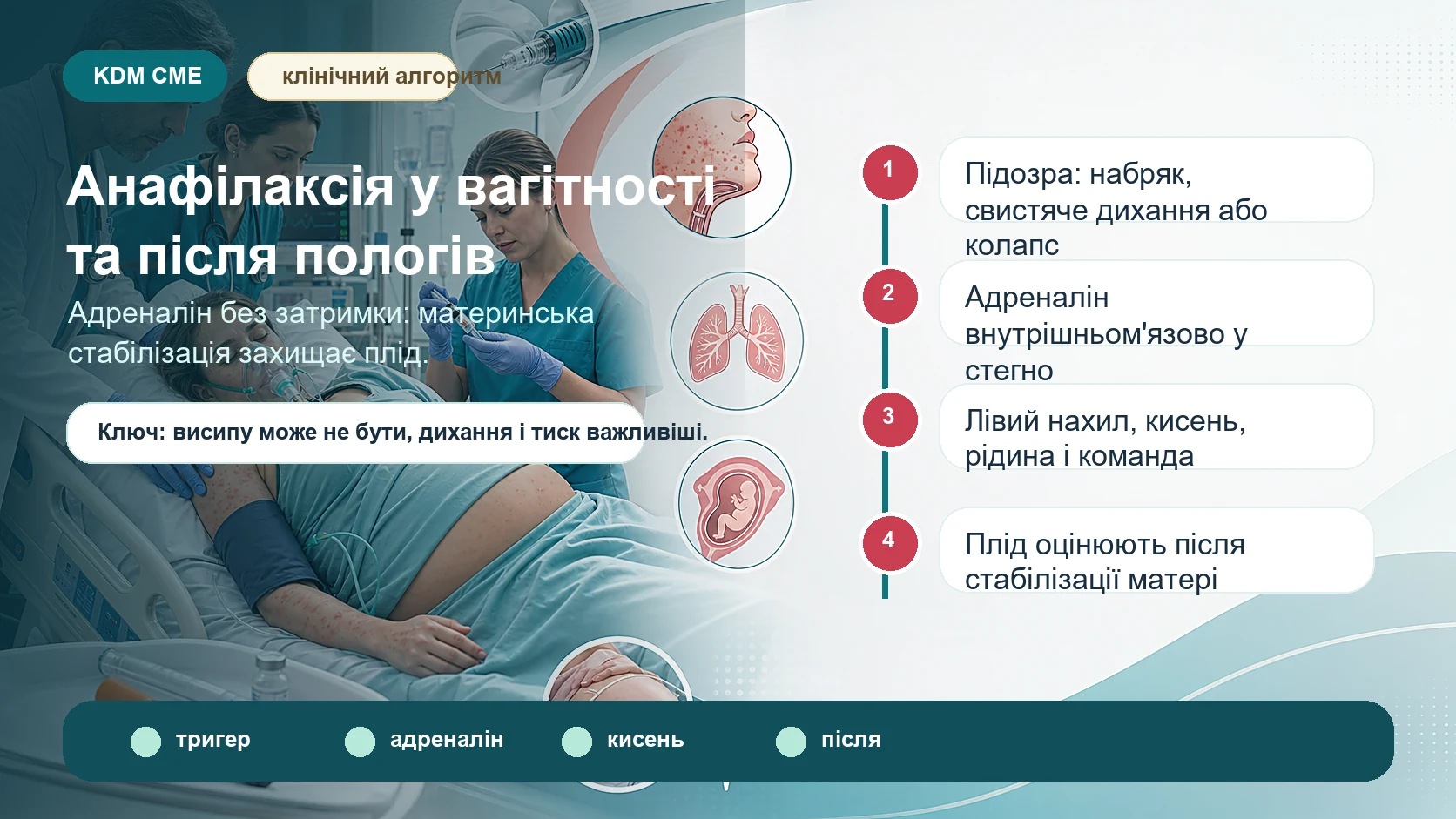 Інфографіка алгоритму анафілаксії у вагітності, пологах і після пологів: раптовий висип, набряк, свистяче дихання, гіпотензія або колапс після ліків, антибіотика, латексу, їжі, укусу чи анестезії; припинити тригер, викликати команду, лівий нахил, адреналін внутрішньом’язово без затримки, кисень, внутрішньовенна рідина, повторна оцінка, оцінка плода після стабілізації матері, спостереження і план безпеки.