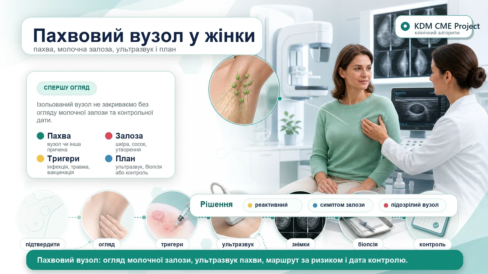 Медична інфографіка KDM CME Project для алгоритму пахвового вузла у жінки: підтвердити пахвову лімфаденопатію, оглянути молочні залози, шкіру і руку, відокремити інфекцію, травму, вакцинацію і лактацію від онкологічної підозри, виконати ультразвукове дослідження пахви, додати мамографію або томосинтез за віком і ризиком, біопсію підозрілого вузла і письмовий контроль.