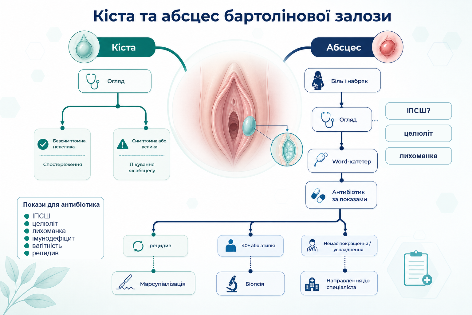 Інфографіка алгоритму кісти та абсцесу бартолінової залози: огляд, кіста, абсцес, біль і набряк, катетер Word, антибіотик за показами, марсупіалізація, рецидив, біопсія при віці 40+ або атипії.