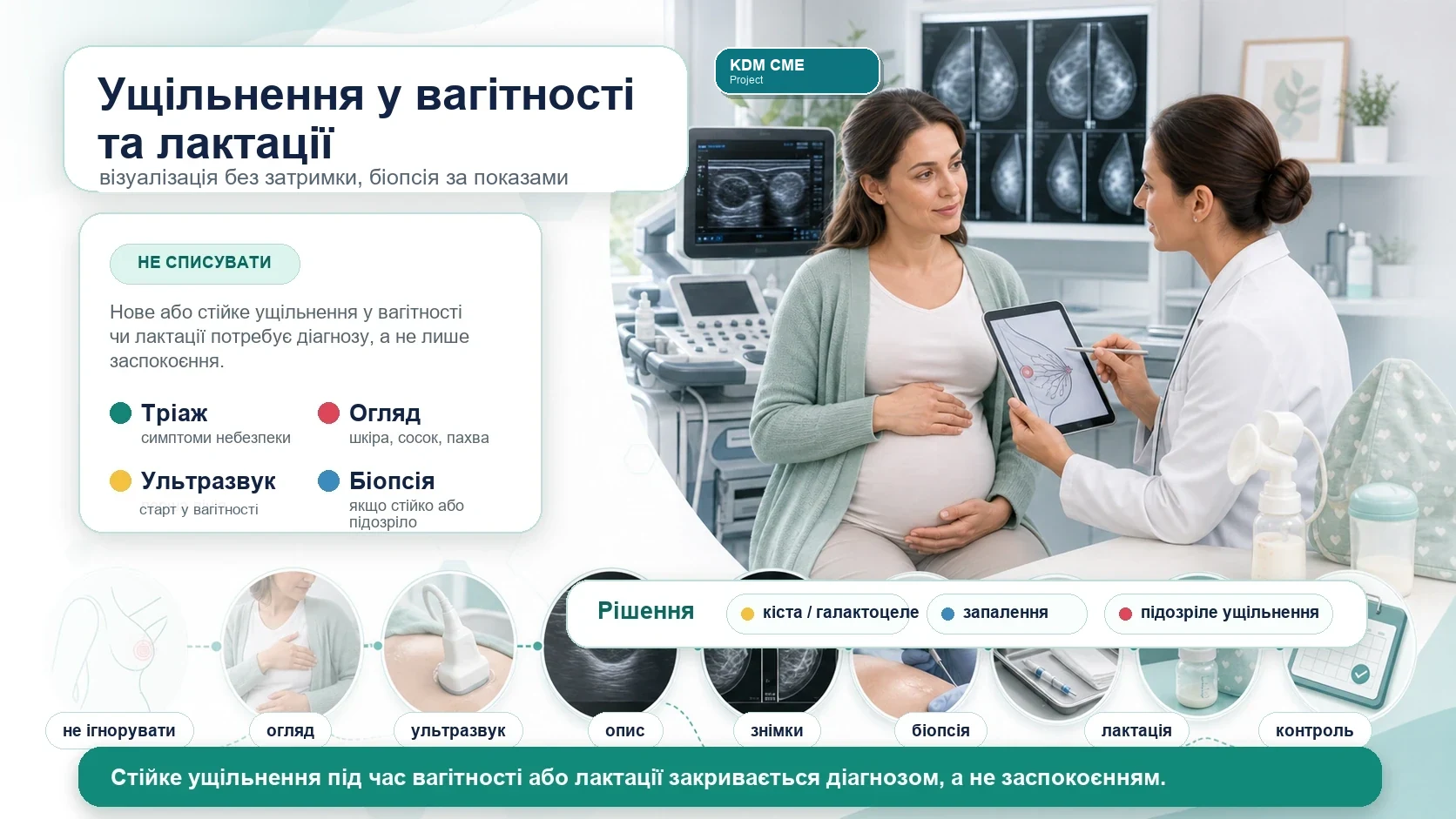 Медична інфографіка KDM CME Project для алгоритму ущільнення молочної залози у вагітності та лактації: не списувати на фізіологію, клінічний огляд, симптоми небезпеки, ультразвукове дослідження у вагітності, візуалізація в лактації за віком і ризиком, діагностична мамографія або томосинтез за показами, безпечна біопсія і відстеження до діагнозу.