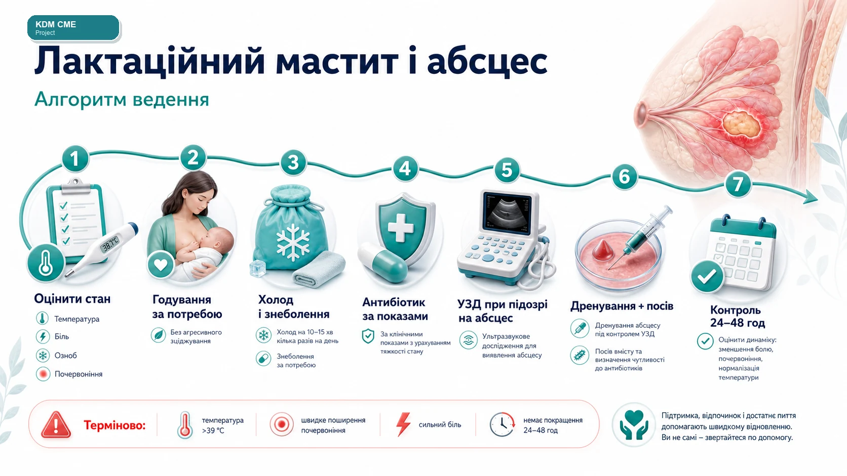 Медична інфографіка KDM CME Project для алгоритму лактаційного маститу і абсцесу молочної залози: оцінка стану, фізіологічне годування без агресивного зціджування, холод і знеболення, антибіотик за показами, ультразвукове дослідження при підозрі на абсцес, дренування, посів і контроль через 24-48 годин.