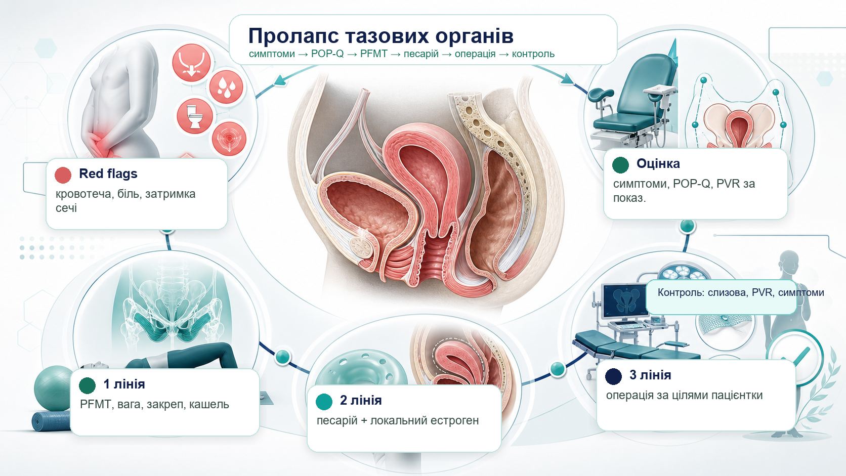 Pelvic organ prolapse clinical pathway infographic: symptoms, POP-Q, pelvic floor therapy, pessary, surgery and follow-up.