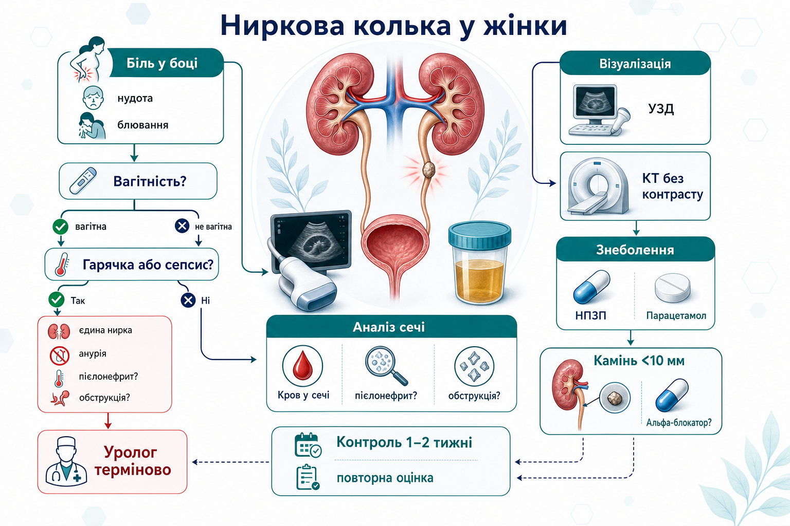 Інфографіка алгоритму ниркової кольки у жінки: біль у боці, вагітність, гарячка або сепсис, аналіз сечі, кров у сечі, ультразвукове дослідження, комп’ютерна томографія без контрасту, знеболення, нестероїдні протизапальні препарати, парацетамол, терміновий уролог, камінь менше 10 мм, альфа-блокатор і контроль через 1-2 тижні.
