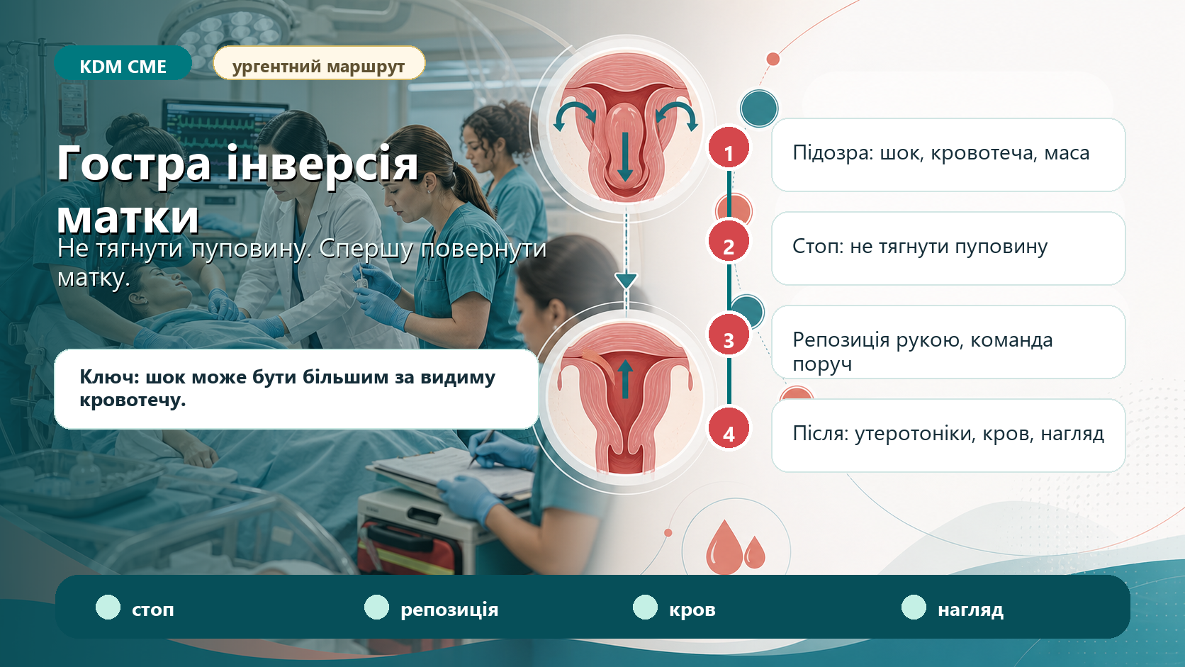 Інфографіка алгоритму гострої інверсії матки після пологів: біль, шок і кровотеча, зупинка тракції за пуповину, ручна репозиція матки, анестезія або токоліз, утеротоніки після репозиції, венозний доступ, компоненти крові, операційна готовність, антибіотикопрофілактика і післяпологовий контроль.