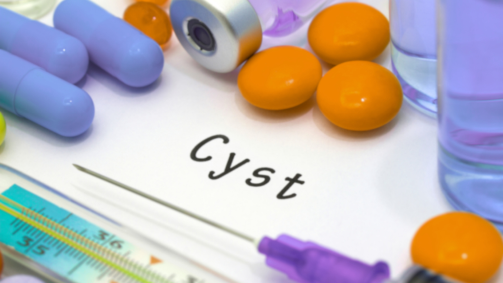 Пухлини яєчників. В фокусі рак та межові пухлини 22 Листопада 2025