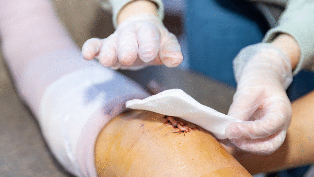 ERAS у гінекології: що справді працює, а що – ні 12 грудня 2026